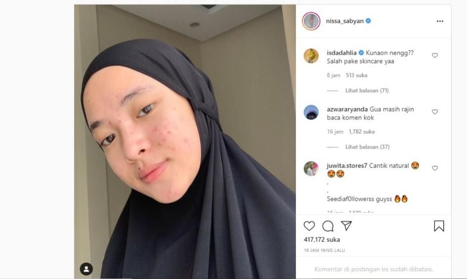 Wajah Berjerawat Nissa Sabyan Jadi Sorotan (Instagram/ nissa_sabyan)