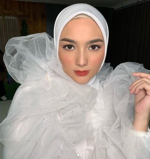 Artis turunkan berat badan secara drastis. (Instagram/citraciki)