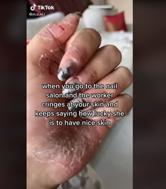 Curhat Wanita Dipermalukan saat Manikur karena Kulit Pecah-pecah (tiktok.com/@m.o.ni.i)