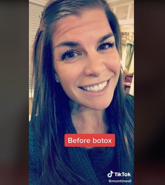 Curhat Ibu Wajahnya Berubah Mengerikan setelah Botox (tiktok.com/@momtimes6)