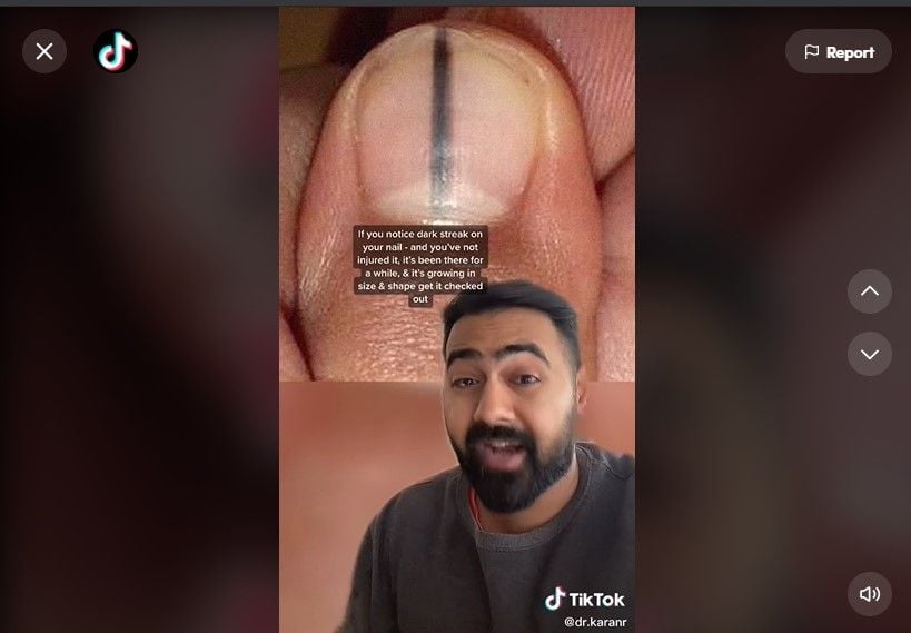 Viral di TikTok! Dokter Ini Ungkap Tampilan Kuku yang Jadi Tanda Penyakit Bahaya. (Dok: TikTok/drkaran)