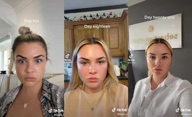 Viral wanita lakukan suntik botox malah dibilang wajahnya menua. (TikTok/@cezza_ta)