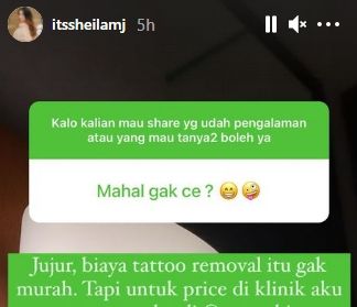 Momen Sheila Marcia hapus tato. (Instagram/itssheilamj)