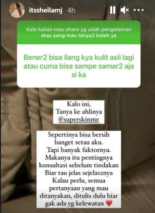 Momen Sheila Marcia hapus tato. (Instagram/itssheilamj)