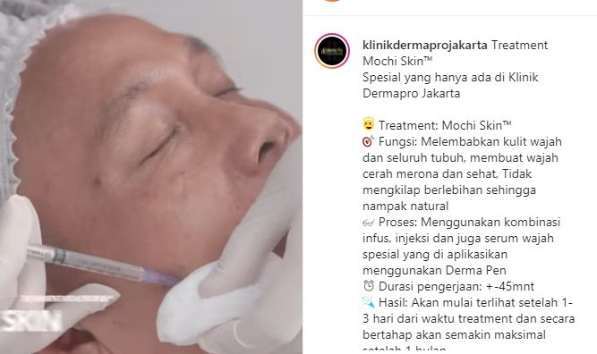 Potret orang tua Ayu Ting Ting perawatan wajah. (Instagram/klinikdermaprojakarta)
