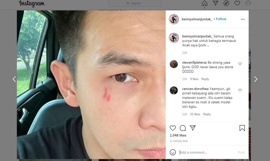 Unggahan Benny Simanjuntak [Instagram]