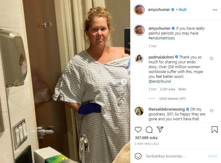 Amy Schumer menderita endometriosis (Instagram)