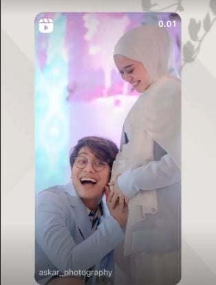 Momen Lesti Kejora dan Rizky Billar pamer kemesraan usai mengaku nikah siri. (Instagram/askar_photography)