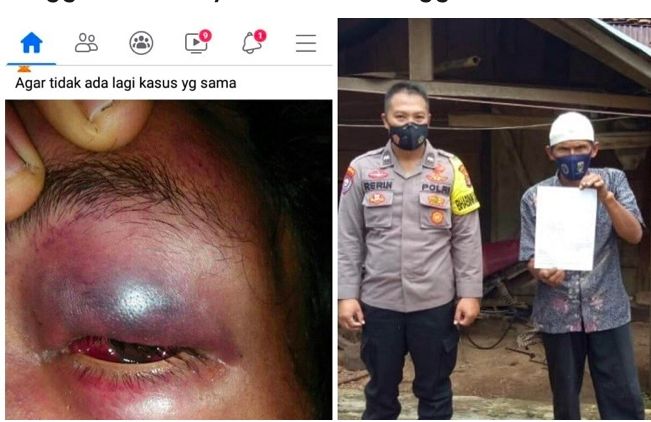 Foto korban yang viral di medsos dan proses perdamaian oleh Polsek Cukuh Balak. LAMPUNGPRO.CO/HUMAS