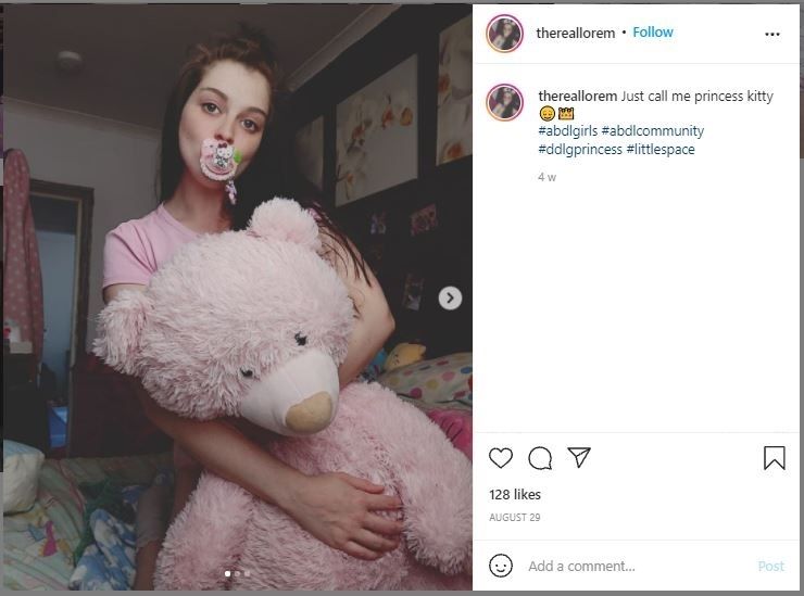 Wanita 24 Tahun yang Masih Berdandan Seperti Bayi, Bisa Atasi Trauma (instagram.com/thereallorem)