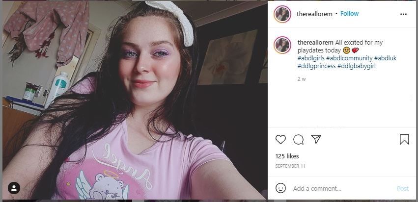 Wanita 24 Tahun yang Masih Berdandan Seperti Bayi, Bisa Atasi Trauma (instagram.com/thereallorem)