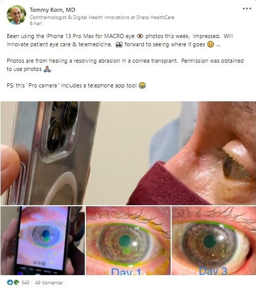 Dokter mata periksa pasien pakai iPhone 13 Pro Max. [LinkedIn]