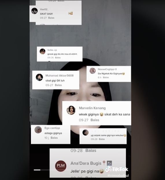 Sering Diejek karena Gigi, Wanita Ini Beri Respons Mengharukan (tiktok.com/@rinnabulbul)