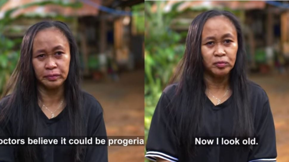 Raizel Calago, gadis 16 tahun asal Filipina yang mengidap progeria. (YouTube/Truly)