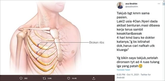 Viral perjuangan ayah tetap bekerja meski tulang iga patah. (Twitter/@asaibrahim)