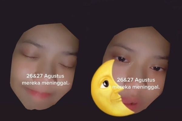 Viral Kisah Cewek Minta Hadiah Kawat Gigi Berakhir Pilu. (TikTok)