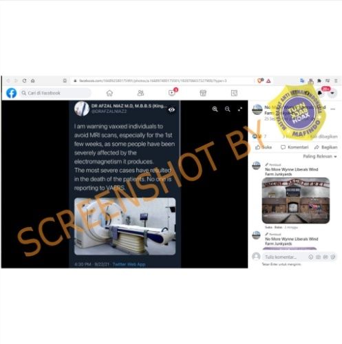 CEK FAKTA Penerima Vaksin Corona Harus Hindari Scan MRI Karena Sebabkan Kematian