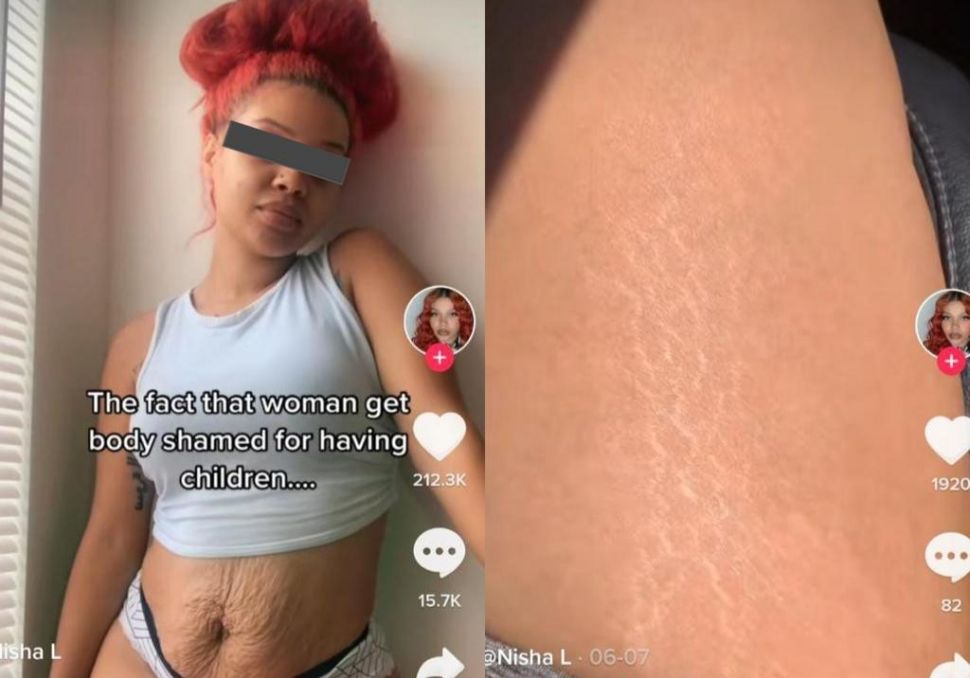 Viral ibu pamerkan kulit kendur dan stretch mark di pinggul ( TikTok)