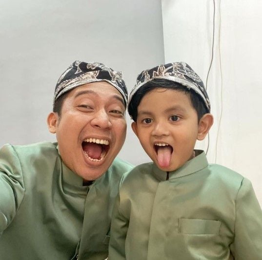 Potret Denny Cagur dan anak angkat. (Instagram/dennycagur)