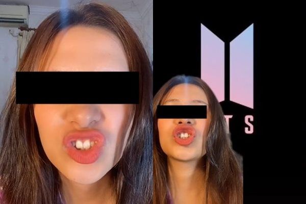 Viral Cewek Dihina Bagian Tubuhnya Ini Mirip Logo BTS. (TikTok)