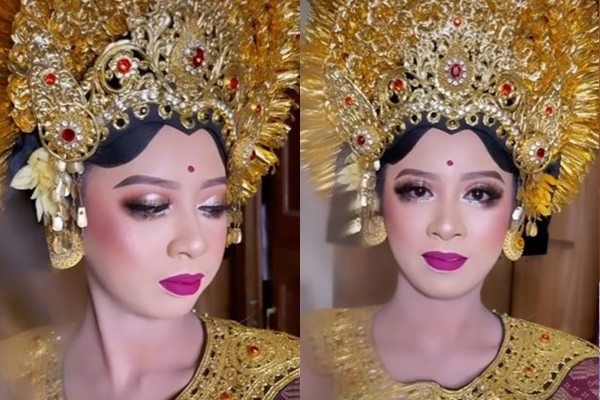 Viral Pengantin Wanita Sakit Mata Sampai Benjol. (TikTok)