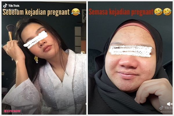 Perempuan Ini Bagikan Foto Sebelum dan Sesudah Hamil. (TikTok)