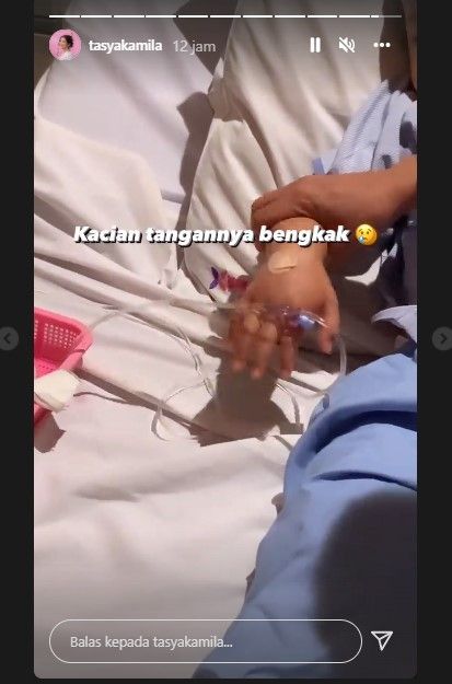 Tangan Arrasya Wardhana Bachtiar bengkak (Instagram)