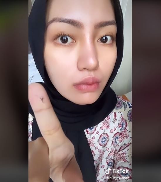Rusak karena Eyelash Perm, Wanita Ini Terpaksa Potong Bulu Mata (tiktok.com/nur_ayishah)