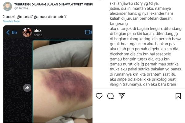 Viral Curhat Wanita Alami Kekerasan Fisik (Twiter/@tubirfess)