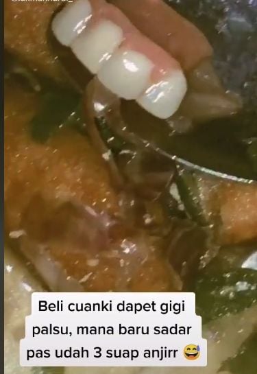 Penemuan gigi palsu di makanan cuanki. (TikTok/lukmannurdi_)