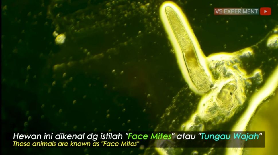 Wujud demodex atau tungau wajah (YouTube VS Experiment)