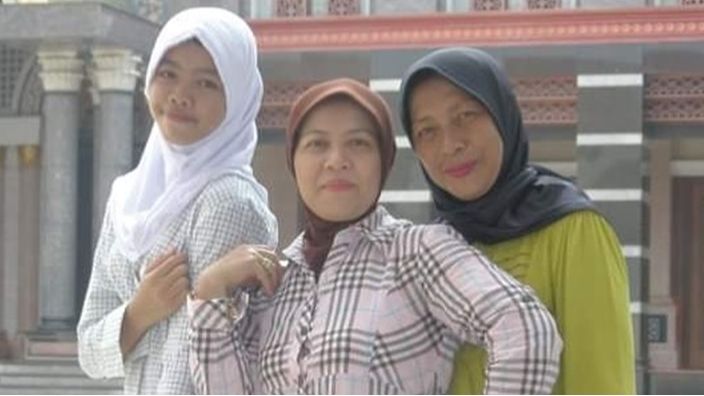 Transformasi Siwi Widi Sejak Sebelum Operasi Plastik (Instagram/@siwiwidipurwanti)