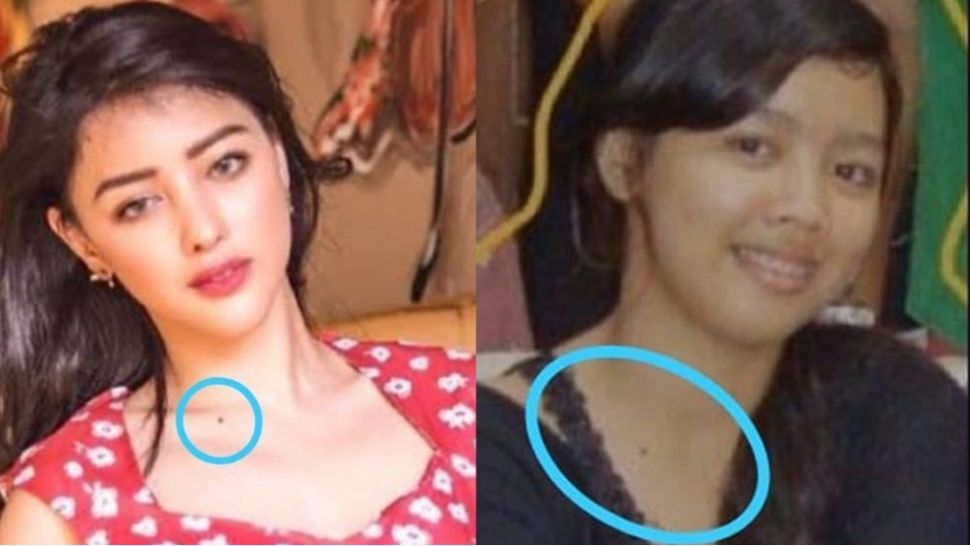 Transformasi Siwi Widi Sejak Sebelum Operasi Plastik (Instagram/@siwiwidipurwanti)