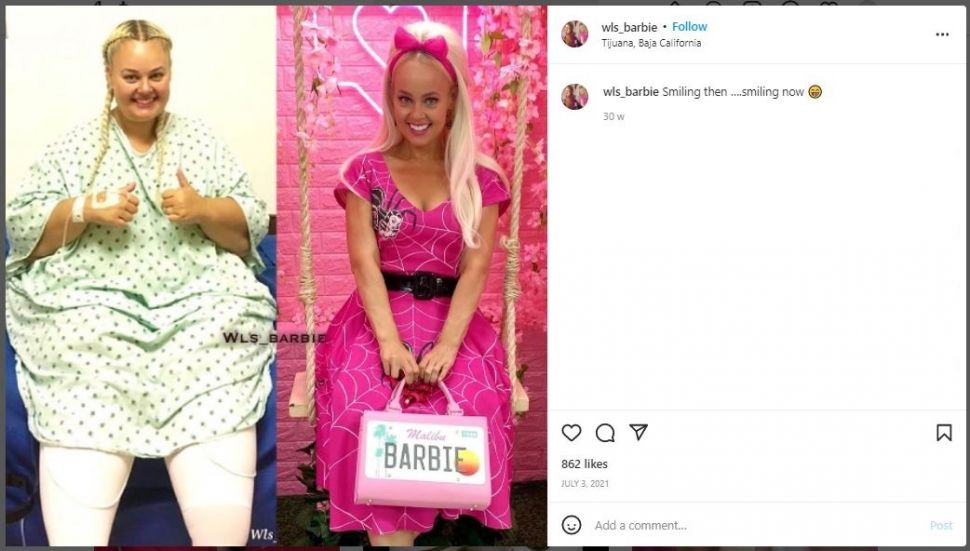 Wanita Turunkan Berat Badan 89 Kg karena Terinspirasi Mirip Barbie (instagram.com/wls_barbie)