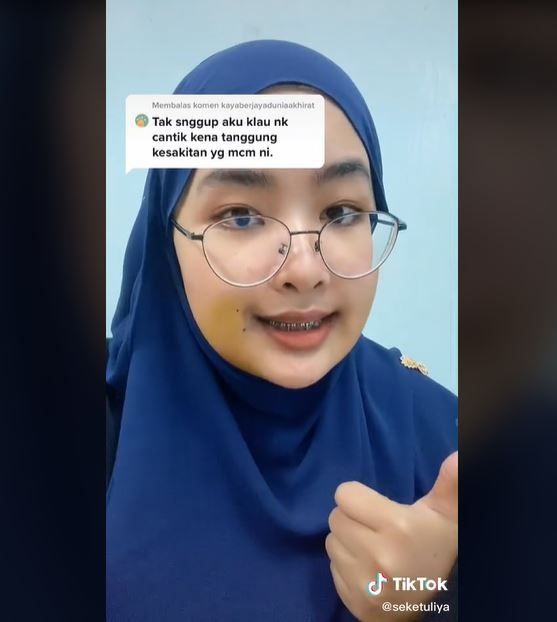 Cerita Wanita Operasi Rahang setelah Penampilan Diejek Mirip Nenek Sihir (tiktok.com/seketuliya)