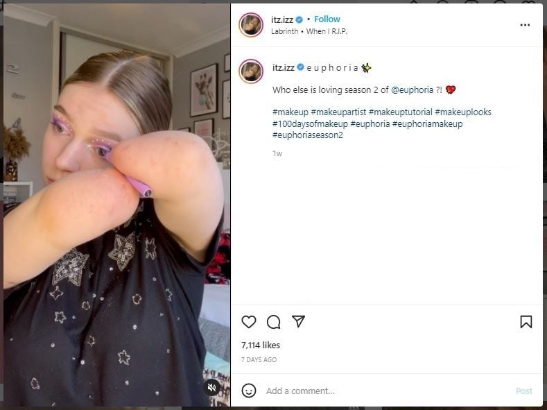 Remaja Viral Jadi Influencer Kecantikan setelah Kehilangan Tangan dan Kaki (instagram.com/itz.izz)