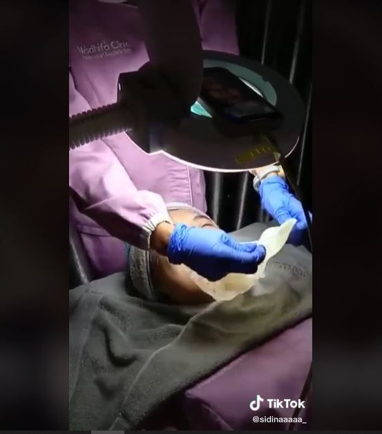 Pegawai Klinik Kecantikan Kena Prank saat Peel Off Masker, Warganet: Auto Trauma (tiktok.com/sidinaaaaa_)