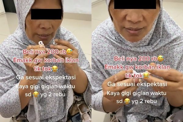 Emak Beli Gigi Palsu Rp200 Ribu, Wujudnya Tak Sesuai Ekspektasi Bikin Publik Bersyukur (TikTok)