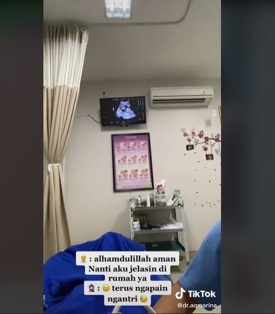 Viral Ibu Cek Kehamilan dengan Dokter Kandungan Suami Sendiri (tiktok.com/dr.aqmarina)