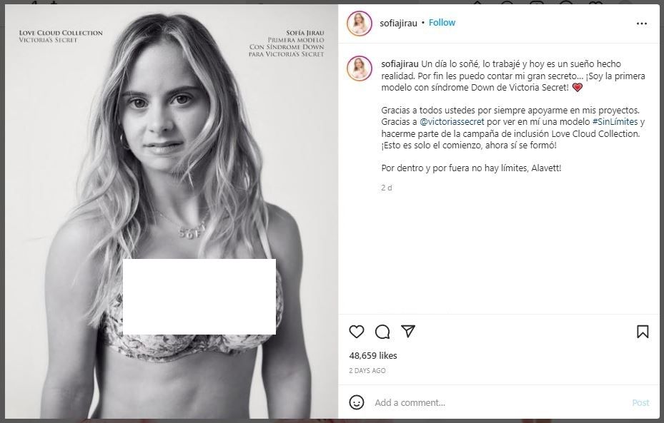 Model Down Syndrome Pertama Victoria Secret (instagram.com/sofiajirau)