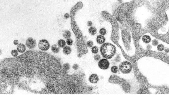 Penampakan virus Lassa (Pusat Pengendalian dan Pencegahan Penyakit AS)