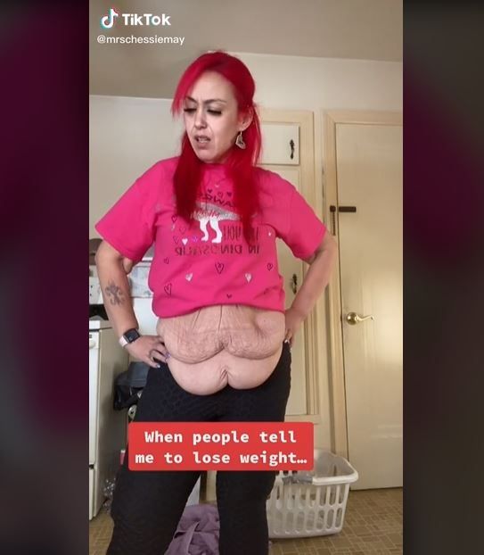 Berat Badan Turun 100 Kg, Wanita Ini Pede Punya Kulit Bergelambir (tiktok.com/@mrschessiemay)