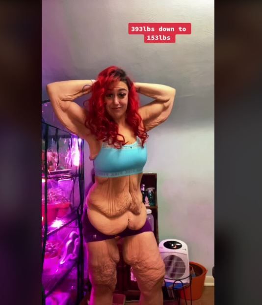 Berat Badan Turun 100 Kg, Wanita Ini Pede Punya Kulit Bergelambir (tiktok.com/@mrschessiemay)