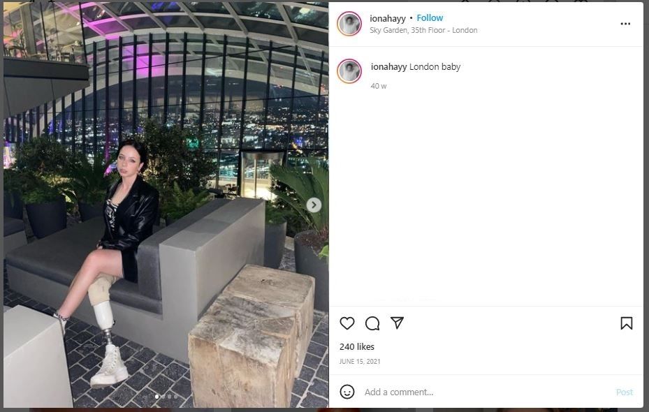 Kehilangan Sebelah Kaki, Remaja Ini Sukses Jadi Model Brand Ternama (instagram.com/ionahayy)