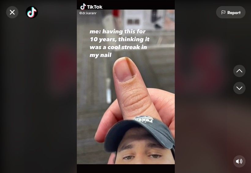 Viral di TikTok! Dokter Ungkap Tanda Penyakit Mematikan Pada Kuku, Cek Sekarang. (Dok: TikTok/dr.karanr)