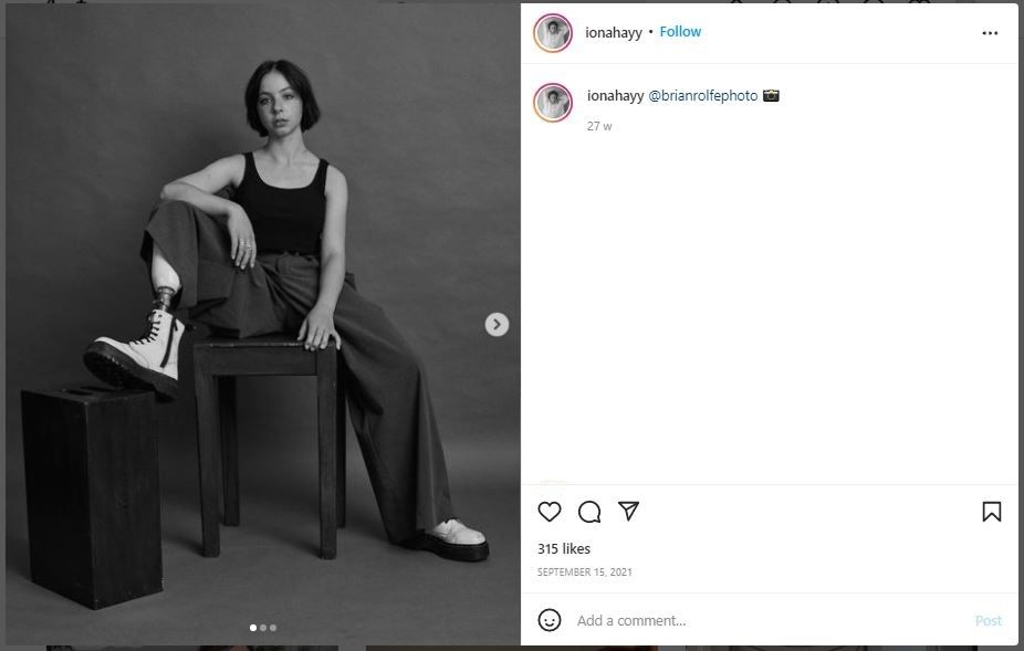 Kehilangan Sebelah Kaki, Remaja Ini Sukses Jadi Model Brand Ternama (instagram.com/ionahayy)