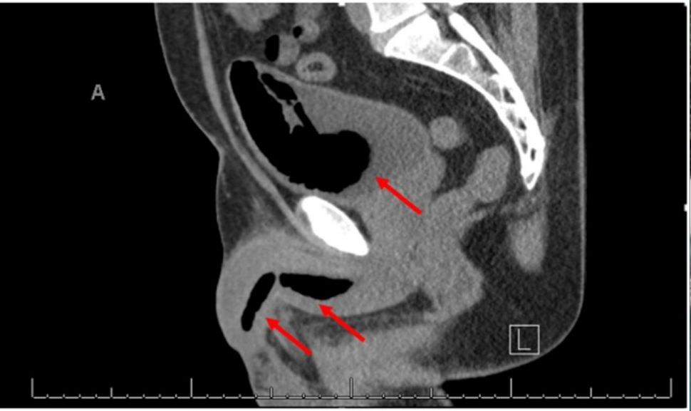 MRI sang pria (Sciencedirect)