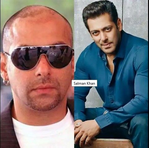 Salman Khan melakukan transplantasi rambut. [Bollywoodlife]