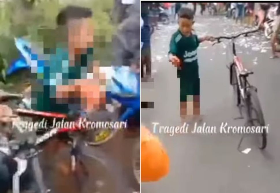 Anak main petasan tangan hancur (instagram.com/andreli_48/)