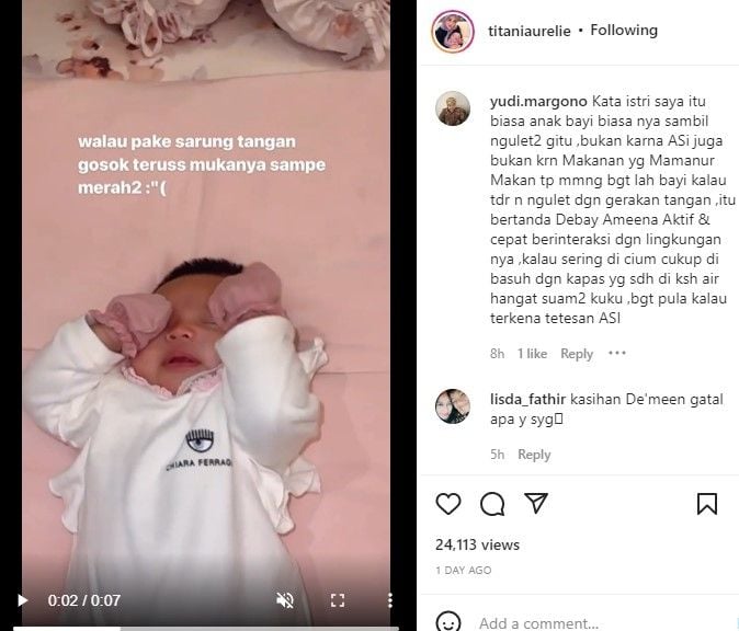 baby Ameena sering garuk-garuk wajah. [titaniaurelie / Instagram]